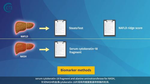 Non-invasive tests of non-alcoholic fatty liver disease