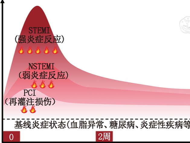 冠心病炎症风险筛查与诊断专家建议