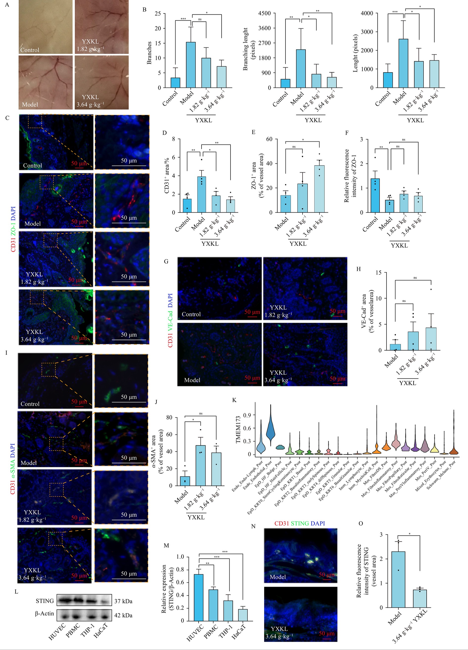 Dual targeting of cutaneous inflammation and vasculopathy <i class="italic">via</i> STING-NF-κB blockade underlies the anti-psoriatic efficacy of Yinxie Granules